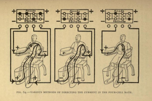 Drawing of Electrical current flows in the four-cell bath from: Galvanism and Faradism by E M Magill